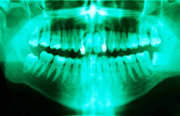 La Clinique Prisma offre-t-elle des services de parodontie ?